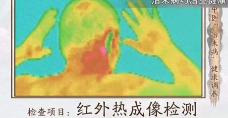 紅外熱成像在中醫中的應用